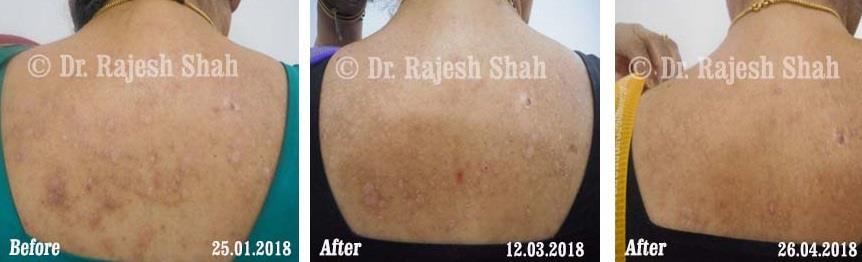 lifeforce homeopathy case-photos
